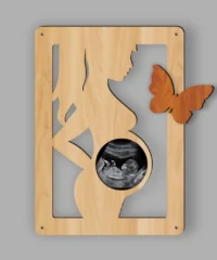 Baby Ultrasound Photo Frame